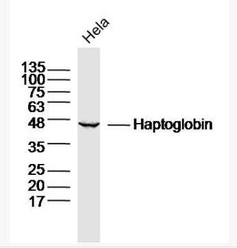 Anti-Haptoglobin antibody -结合珠蛋白/触珠蛋白抗体,Haptoglobin