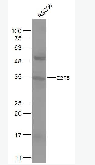 Anti-E2F5 antibody -转录因子E2F-5抗体,E2F5