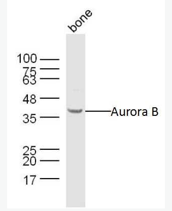 Anti-Aurora B antibody -有絲分裂激酶B抗體,Aurora B