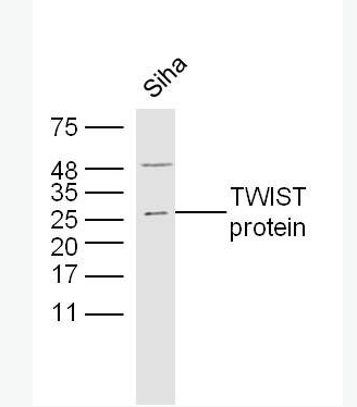 Anti-TWIST antibody -TWIST蛋白抗体,TWIST
