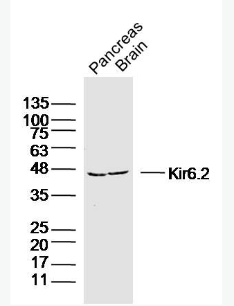 Anti-Kir6.2 antibody -ATP敏感性鉀通道亞基kir6.2抗體,Kir6.2