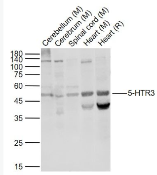 Anti-5-HTR3 antibody -5-羟色胺受体3抗体,5-HTR3