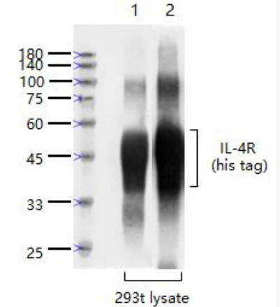 Anti-IL-4R antibody -白细胞介素4受体抗体,IL-4R