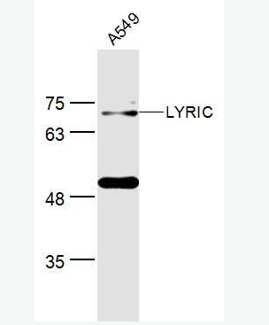 Anti-LYRIC antibody -星形胶质细胞升高基因1抗体,LYRIC