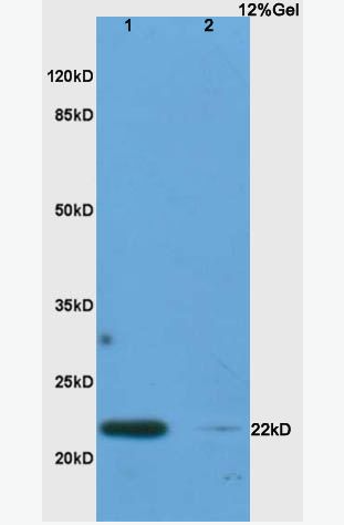 Anti-IL17C antibody -白介素-17C抗体,IL17C