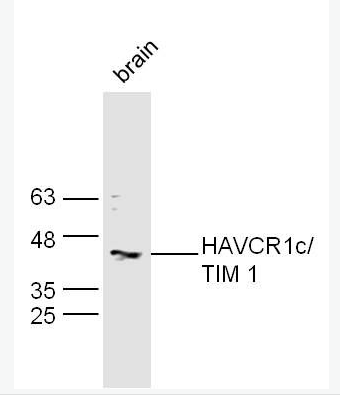 Anti-HAVCR1 antibody -肾损伤分子1/甲型肝炎病毒细胞受体1抗体,HAVCR1