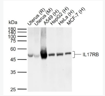 Anti-IL17RB antibody -白介素-17B受体抗体,IL17RB