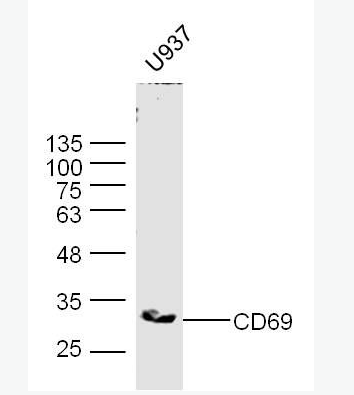 Anti-CD69 antibody -活化诱导分子CD69抗体,CD69