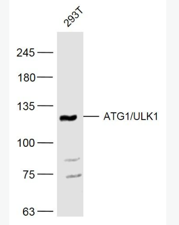 Anti-ATG1/ULK1 antibody -自噬相关蛋白1抗体,ATG1/ULK1