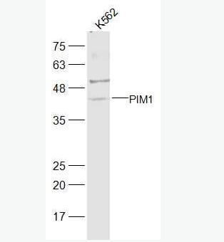 Anti-PIM1 antibody -丝氨酸/苏氨酸激酶蛋白Pim1抗体,PIM1