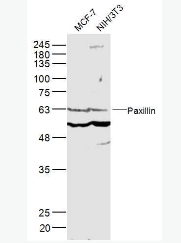 Anti-Paxillin antibody -桩蛋白Paxillin抗体,Paxillin