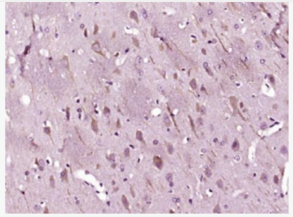 Anti-LC3B antibody -自噬微管相关蛋白轻链3抗体,LC3B