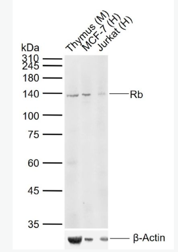 Anti-Rb antibody -成视网膜细胞瘤基因抗体,Rb