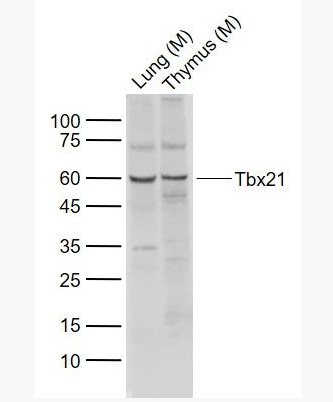 Anti-Tbx21 antibody -T细胞介导的转录调节因子Tbx21抗体,Tbx21