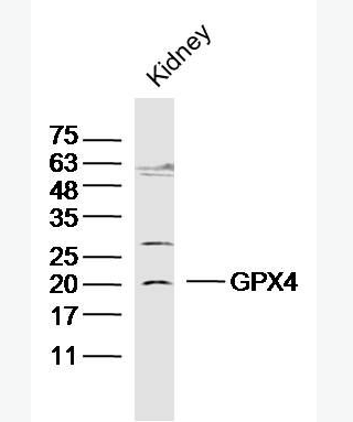 Anti-GPX4 antibody -中文名称谷胱甘肽过氧化酶4抗体,GPX4