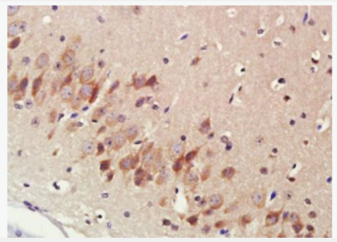 Anti-Cytochrome P450 17A1 antibody -细胞色素P450 17抗体,Cytochrome P450 17A1