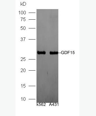 Anti-GDF15 antibody -生长分化因子15/巨嗜细胞抑制因子1抗体,GDF15