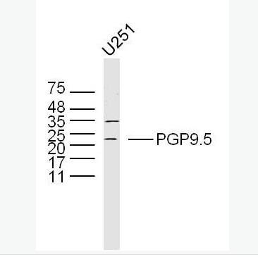 Anti-PGP9.5 antibody -神经细胞胞浆蛋白9.5/蛋白基因产物9.5抗体,PGP9.5