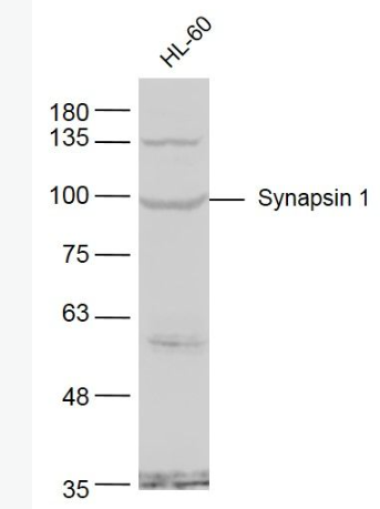 Anti-Synapsin 1 antibody -神經(jīng)突觸素1抗體,Synapsin 1