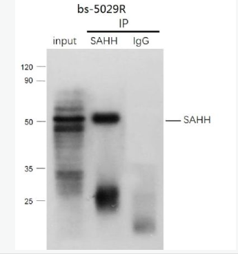 Anti-SAHH antibody -S腺苷L-同型半胱氨酸水解酶抗体,SAHH