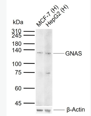 Anti-GNAS antibody -GNAS抗体,GNAS