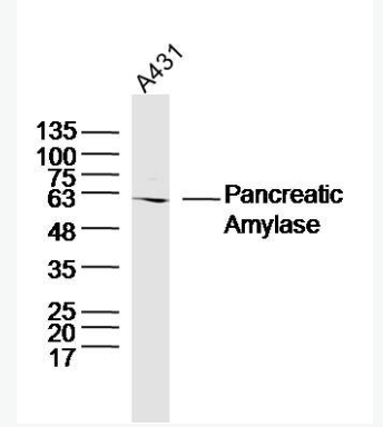 Anti-Pancreatic Amylase antibody -胰淀粉酶抗体,Pancreatic Amylase