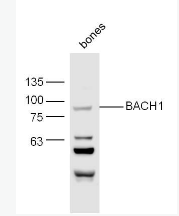 Anti-BACH1 antibody -转录调节蛋白BACH1抗体,BACH1