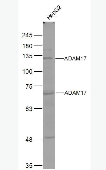 Anti-ADAM17 antibody -肿瘤坏死因子α转换酶抗体,ADAM17