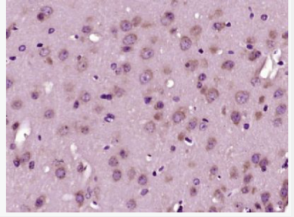 Anti-HMGCR antibody -三羥基三甲基輔酶A還原酶抗體,HMGCR