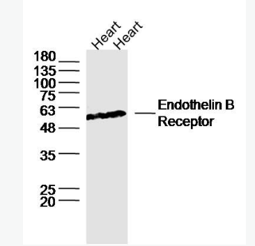 Anti-Endothelin B Receptorantibody -內(nèi)皮素B受體抗體,Endothelin B Receptor