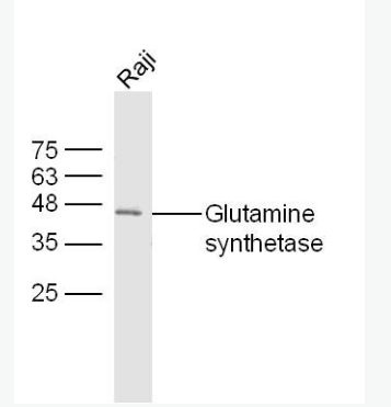 Anti-Glutamine synthetase antibody -谷氨酰胺合成酶/谷氨酸氨连接酶抗体,Glutamine synthetase