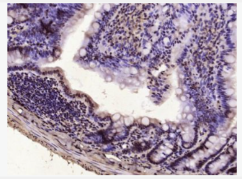 Anti-Vitamin D Receptor antibody -维生素D3受体抗体,Vitamin D Receptor