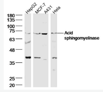 Anti-Acid sphingomyelinase antibody -酸性神经鞘磷脂酶抗体,Acid sphingomyelinase