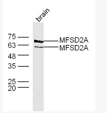 Anti-MFSD2A antibody -促进调解蛋白家族2A抗体,MFSD2A