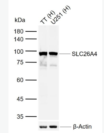 Anti-SLC26A4 antibody -钠碘单独转运蛋白SLC26A4抗体,SLC26A4