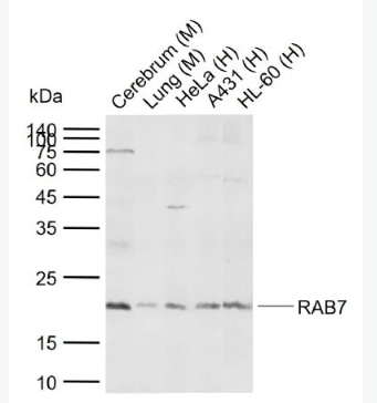 Anti-RAB7A antibody -RAS癌基因相关蛋白RAB7抗体,RAB7A
