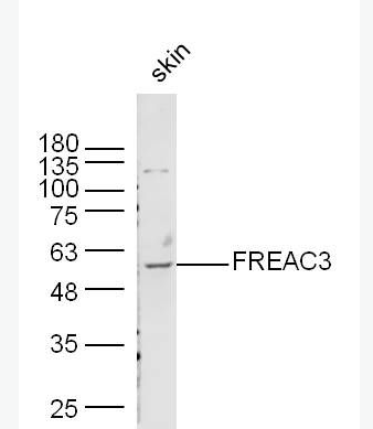 Anti-FREAC3 antibody -叉头相关转录因子3/FOXC1抗体,FREAC3