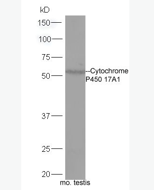 Anti-Cytochrome P450 17A1 antibody -细胞色素C P450 17A1抗体,Cytochrome P450 17A1