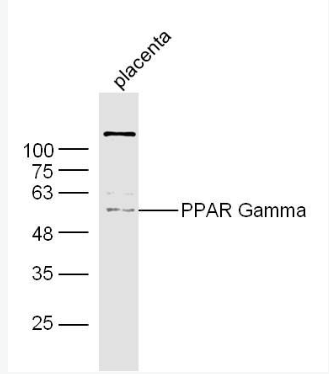 Anti-PPAR Gamma antibody -过氧化酶活化增生受体γ抗体,PPAR Gamma