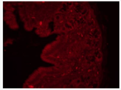 Anti-MLCK antibody -肌球蛋白輕鏈激酶抗體,MLCK