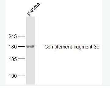 Anti-Complement fragment 3c antibody -補(bǔ)體片段C3c抗體,Complement fragment 3c