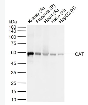 Anti-CAT antibody -过氧化氢酶抗体,CAT