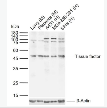 Anti-Tissue factor antibody -组织因子（CD142）抗体,Tissue factor