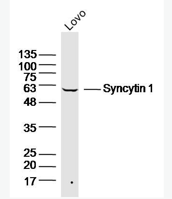 Anti-Syncytin 1 antibody -合胞素1抗體,Syncytin 1