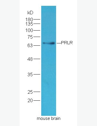 Anti-PRLR antibody -泌乳素受体抗体,PRLR