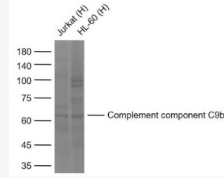 Anti-Complement component C9b antibody -补体C9b抗体,Complement component C9b