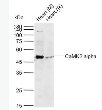 Anti-CaMK2 alpha antibody -钙/钙调素依赖蛋白激酶2α抗体,CaMK2 alpha