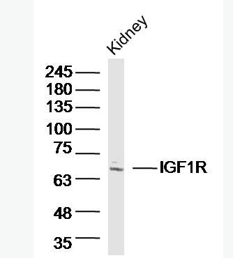 Anti-IGF1R antibody -胰岛素样生长因子1受体抗体,IGF1R