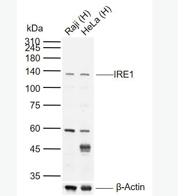 Anti-IRE1 antibody -内质网核信号转导蛋白a1抗体,IRE1