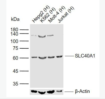 Anti-SLC40A1 antibody -细胞膜铁转运蛋白FP1抗体,SLC40A1